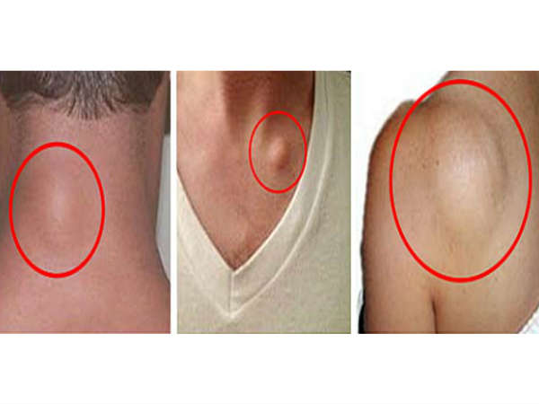 നിങ്ങളുടെ ശരീരത്തില് ഇതുണ്ടോ, എങ്കില്.... നിങ്ങളുടെ ശരീരത്തില് ഇതുണ്ടോ, എങ്കില്....