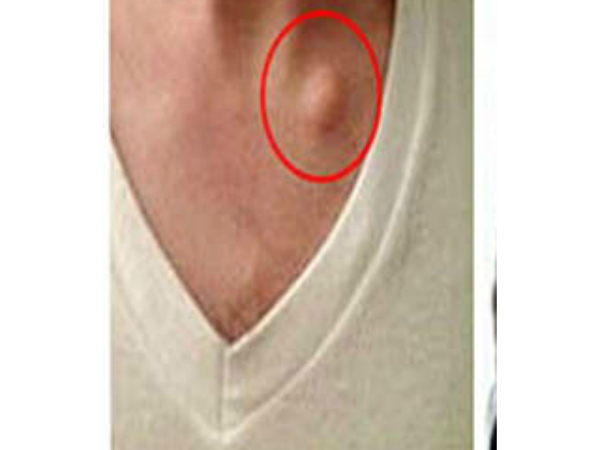 നിങ്ങളുടെ ശരീരത്തില് ഇതുണ്ടോ, എങ്കില്.... നിങ്ങളുടെ ശരീരത്തില് ഇതുണ്ടോ, എങ്കില്....