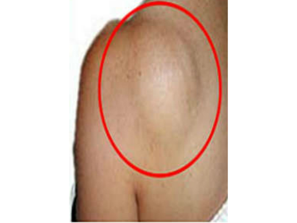 നിങ്ങളുടെ ശരീരത്തില് ഇതുണ്ടോ, എങ്കില്.... നിങ്ങളുടെ ശരീരത്തില് ഇതുണ്ടോ, എങ്കില്....