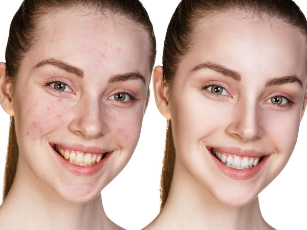 ഉരുളക്കിഴങ്ങെന്ന അത്ഭുതം