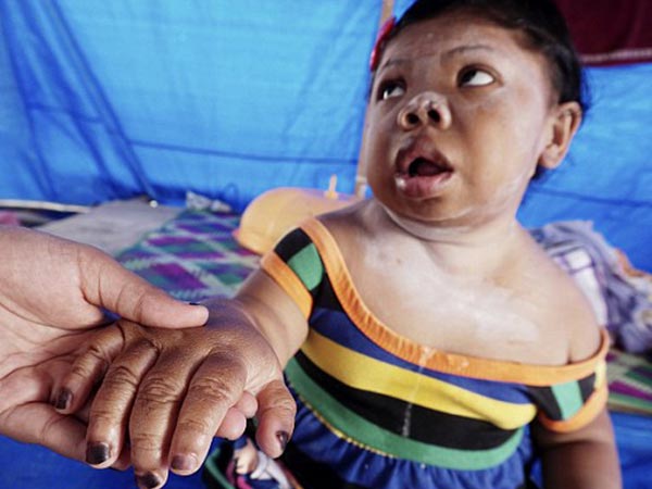 തൂക്കം വെറും 20 കിലോ