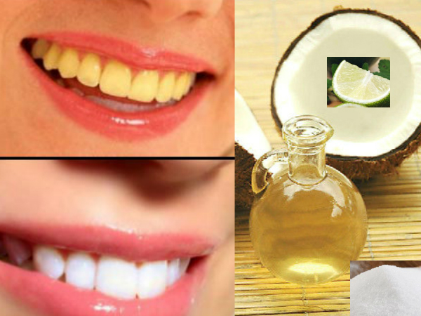 2 മിനിറ്റില്‍ വെളുത്ത പല്ലിന് വെളിച്ചെണ്ണ വിദ്യ