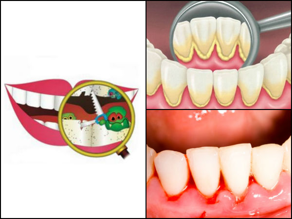 ആരോഗ്യമുള്ള ടിഷ്യൂ 