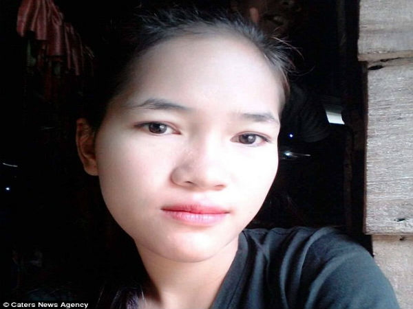 പല്ല് പറിച്ചതിനു ശേഷം പല്ല് പറിച്ചതിനു ശേഷം