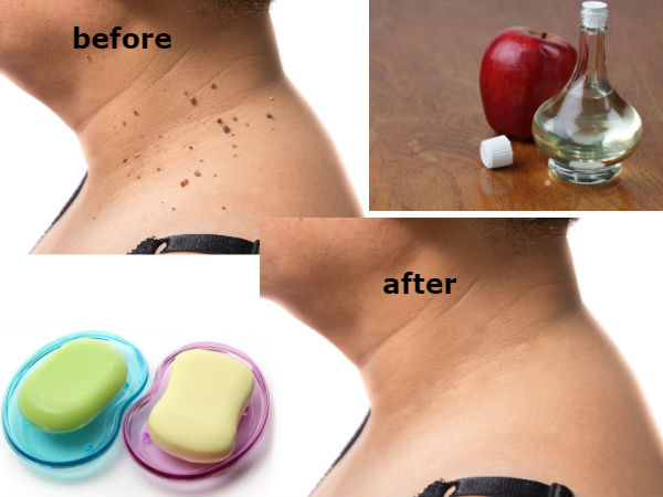  രണ്ടാഴ്ചയ്ക്ക് ശേഷം