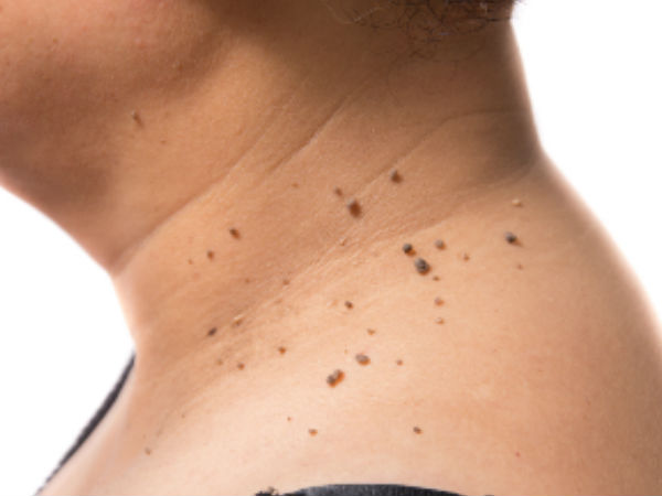  കാരണം വൈറസ്