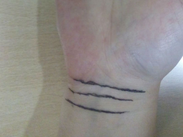 നിങ്ങളുടെ കൈത്തണ്ടയില് ഈ രേഖകളുണ്ടോ, എങ്കില് നിങ്ങളുടെ കൈത്തണ്ടയില് ഈ രേഖകളുണ്ടോ, എങ്കില്