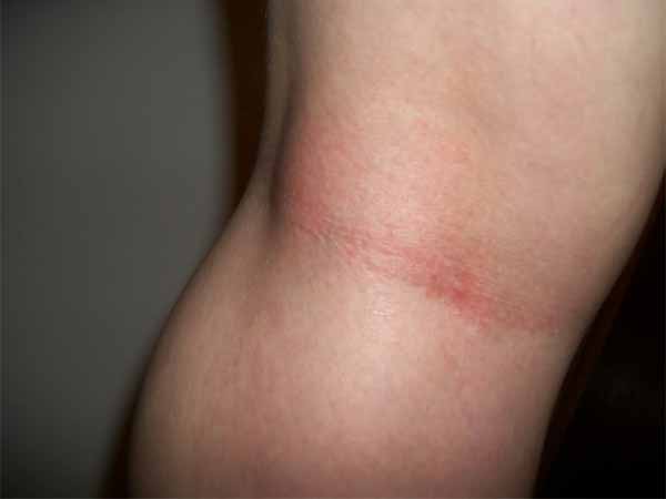 മുട്ടിന് താഴെ