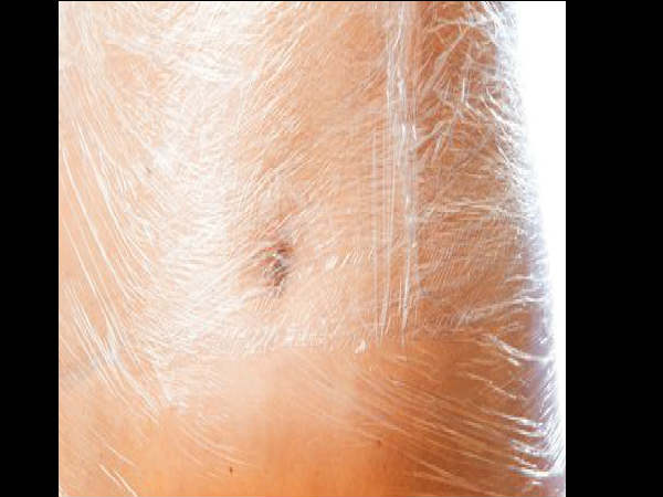 ഇഞ്ചിയും പ്ലാസ്റ്റിക് കവറും, അരയും വയറും രാത്രി കൊണ്ടു കുറയും