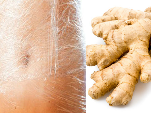 ഇഞ്ചിയും പ്ലാസ്റ്റിക് കവറും, അരയും വയറും രാത്രി കൊണ്ടു കുറയും