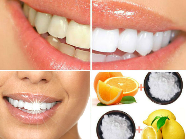 2 മിനിറ്റില്‍ പല്ലിന്റെ മഞ്ഞനിറം മാറും!!