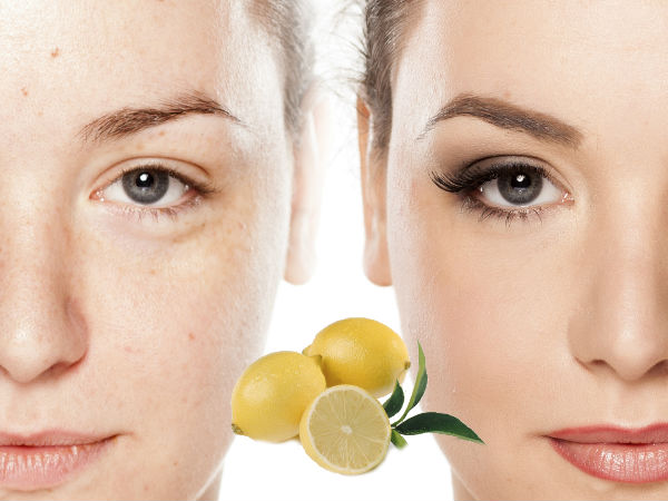  വിറ്റാമിന്‍ സി