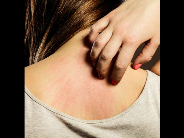  ചര്‍മ്മ രോഗങ്ങള്‍