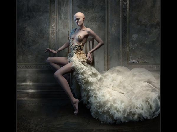  ജനിതകരോഗത്തിന്റെ പിടിയില്‍