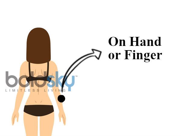 ദേഹത്തെ മറുകുകള്‍ പറയും രഹസ്യം!!