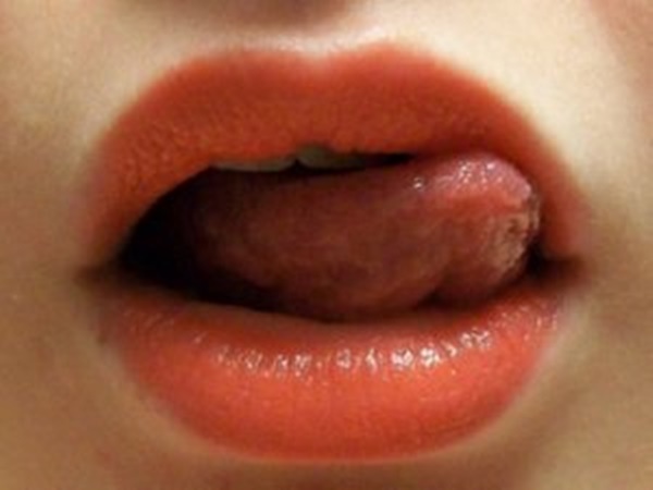 നാവു പറയും ആരോഗ്യം നാവു പറയും ആരോഗ്യം