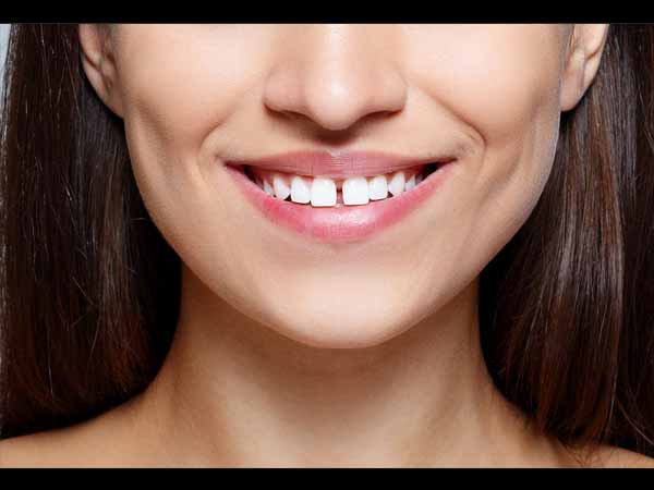 പല്ലുകള്‍