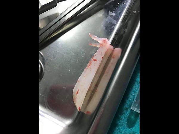 ഇത് എങ്ങനെ സംഭവിച്ചു?