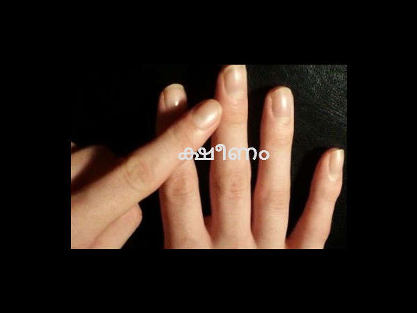 തളര്‍ച്ചയും ക്ഷീണവും