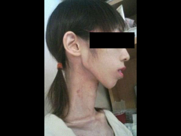 ഛര്‍ദ്ദിച്ചതിന്റെ പ്രതികാരം