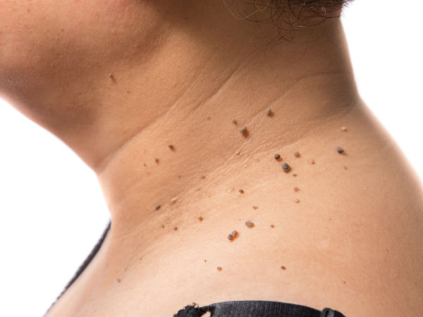 പച്ചഇഞ്ചി 