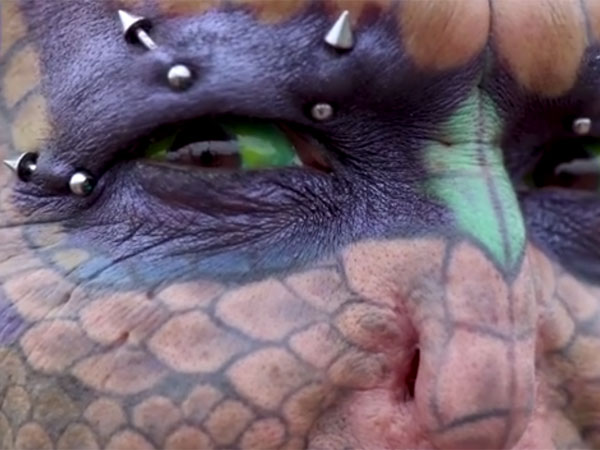 എയ്ഡ്‌സ് ബോധവല്‍ക്കരണം