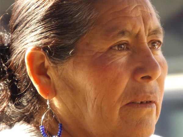 ഒരാളുടെ നെറ്റി അല്പം ഉള്ളിലേയ്ക്കു വലിഞ്ഞതാണെങ്കില് ഒരാളുടെ നെറ്റി അല്പം ഉള്ളിലേയ്ക്കു വലിഞ്ഞതാണെങ്കില്