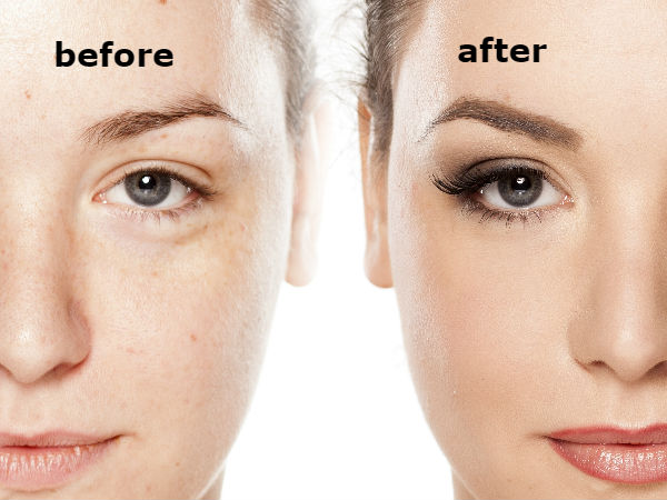 മൈക്രോബാള്‍ഡിങ് ഒരു പരിഹാരമാണ്