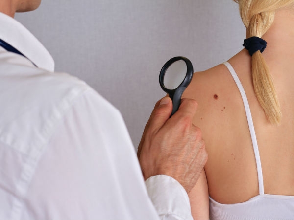 പരന്ന അരിമ്പാറ ,അംഗുലിത അരിമ്പാറ,ആണി അഥവാ പാദതല അരിമ്പാറ