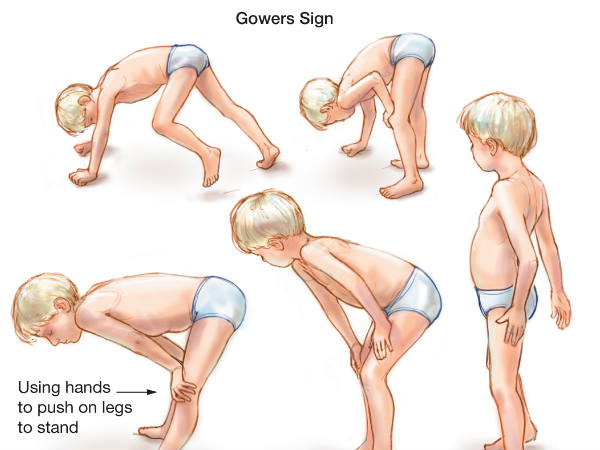 ലക്ഷണങ്ങളുടെ വകഭേദവും 