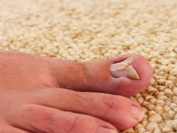 ലക്ഷണങ്ങള്‍ ഇവയാണ്