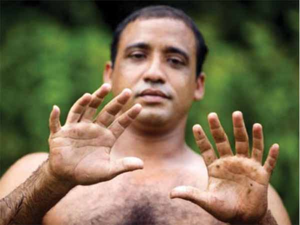 രോഗങ്ങള്‍ തടയാന്‍ 