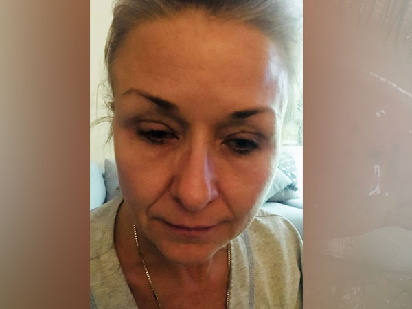 തെരേസ ലിഞ്ച്