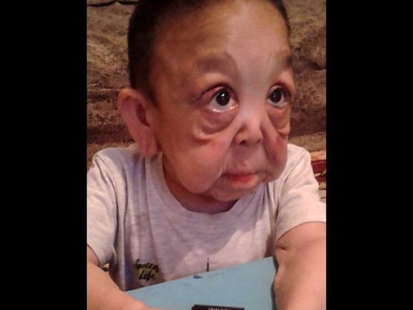 ഫ്രീ സര്‍ജറി