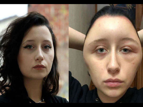  ചെയ്ത തെറ്റ് ഇതാണ്