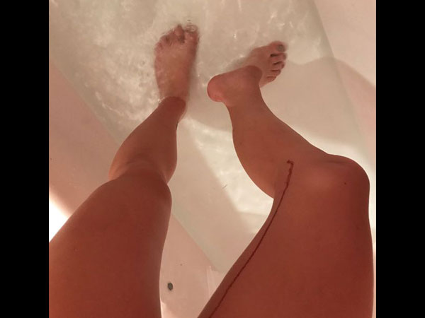 ഇതിന്റെ ചിത്രങ്ങള്‍