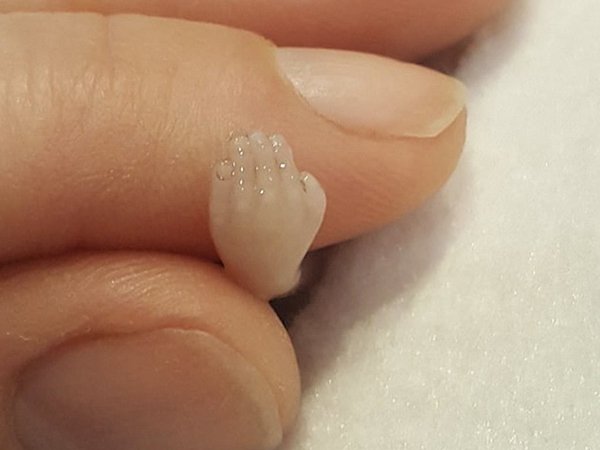  മെഡിക്കല്‍ വേസ്റ്റ് അല്ലാതെ