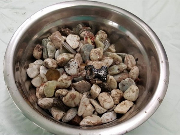 വിശദമായ പരിശോധന