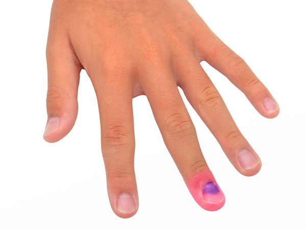 പ്രമേഹത്തിന്റെ സൂചനയും