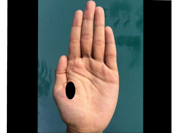 ഗ്യാസ്, അസിഡിറ്റി 