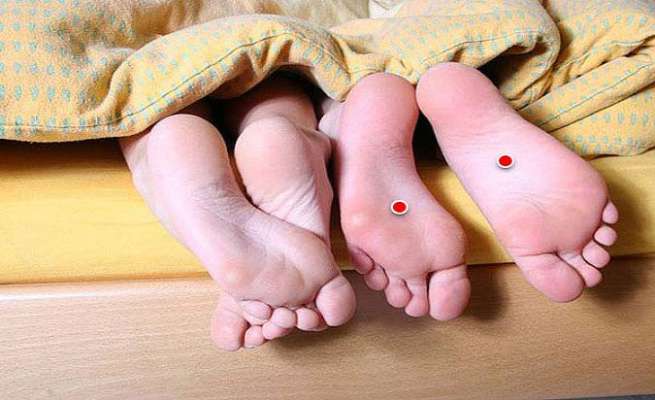 അക്യുപംങ്ചര്‍