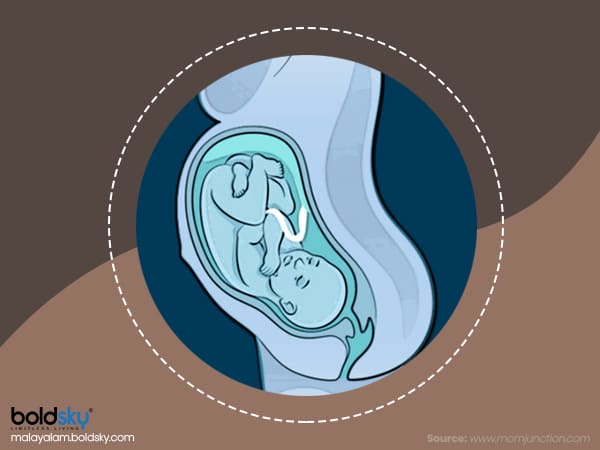 കോംപൗണ്ട് പൊസിഷൻ