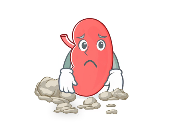 കിഡ്നി സ്റ്റോൺ ഇല്ലാതാക്കാൻ