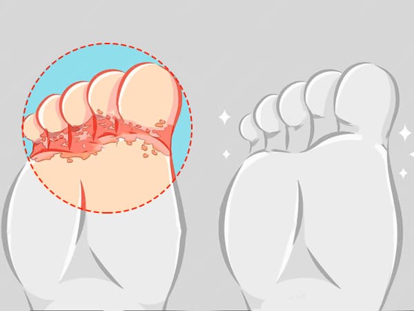 പ്രതിരോധിക്കേണ്ടത് എങ്ങനെ പ്രതിരോധിക്കേണ്ടത് എങ്ങനെ