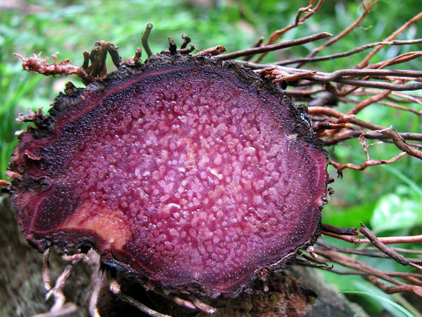  അനോറെക്സിയക്ക് പരിഹാരം