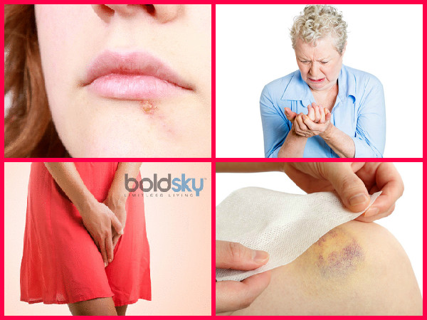  ലക്ഷണങ്ങൾ