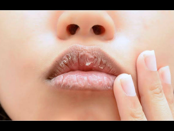 സൂര്യപ്രകാശം അധികം കൊള്ളുന്നത്