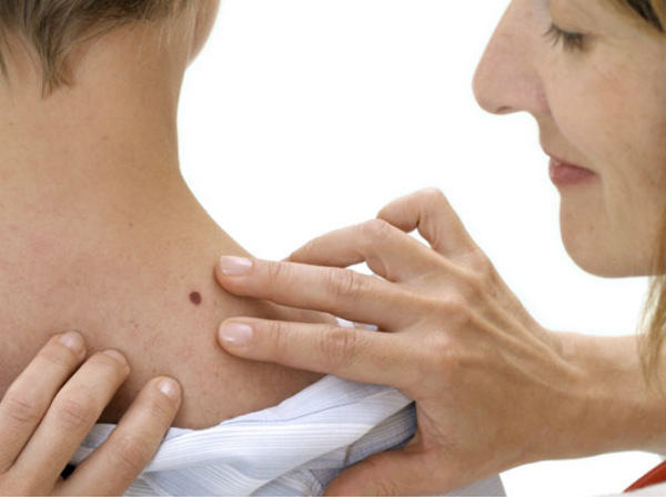 കൃത്യമല്ലാത്ത മറുകുകള്‍