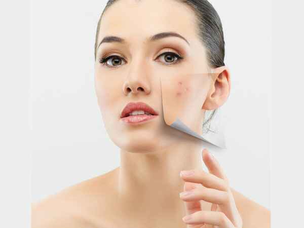 മുഖത്തെ ചുളിവുകളും വരകളും