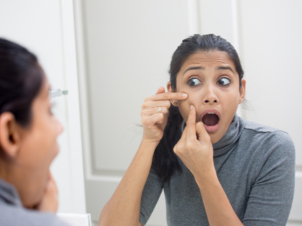 ബ്ലാക്ക്‌ഹെഡ്‌സ് നീക്കാന്‍